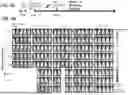 Fig. 09 - IGG4 HINGE-CONTAINING CHIMERIC ANTIGEN RECEPTORS TARGETING GLYPICAN-3 (GPC3) AND USE THEREOF