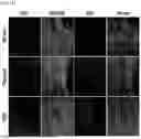 Fig. 16 - COMPOSITIONS AND METHODS FOR REPAIRING DAMAGE TO SKELETAL MUSCLE