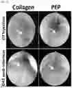 Fig. 20 - COMPOSITIONS AND METHODS FOR REPAIRING DAMAGE TO SKELETAL MUSCLE