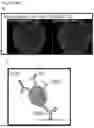 Fig. 28 - COMPOSITIONS AND METHODS FOR REPAIRING DAMAGE TO SKELETAL MUSCLE