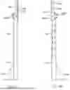 Fig. 07 - MODULAR AND ADJUSTABLE UPRIGHT REPAIR DEVICE FOR INDUSTRIAL STORAGE RACKS
