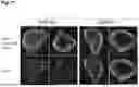 Fig. 72 - PRODUCTION METHOD FOR SHEET-LIKE RETINAL TISSUE