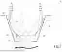 Fig. 04 - DEVICE FOR INSPECTING A HUMAN BODY PORTION AND ASSOCIATED METHOD