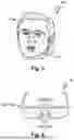 Fig. 06 - METHOD FOR VIRTUAL PREDICTION OF A REAL FIT OF A REAL EYEGLASSES FRAME ON THE HEAD OF A PERSON