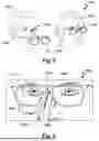 Fig. 07 - METHOD FOR VIRTUAL PREDICTION OF A REAL FIT OF A REAL EYEGLASSES FRAME ON THE HEAD OF A PERSON