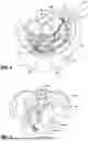 Fig. 05 - Method of Suturing a Prosthetic to Human Tissue