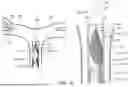 Fig. 02 - EMBOLUS REMOVAL APPARATUS AND METHODS