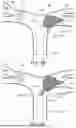 Fig. 09 - EMBOLUS REMOVAL APPARATUS AND METHODS