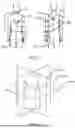 Fig. 02 - IMPROVING MAPPING OF AN ANATOMICAL CAVITY AND/OR LOCATION TRACKING IN THE ANATOMICAL CAVITY