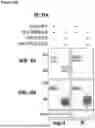Fig. 167 - COMPOSITIONS AND METHODS FOR TREATING ALZHEIMER'S DISEASE UTILIZING A TRANSCRIPTIONAL MASTER REGULATOR OF THE RETROMER COMPLEX