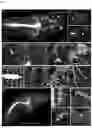 Fig. 09 - Transparent Embedding Solvent System and Use Thereof