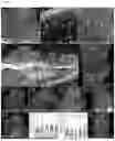 Fig. 11 - Transparent Embedding Solvent System and Use Thereof