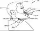 Fig. 01 - Blunt Holder Headset Device