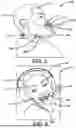 Fig. 03 - Blunt Holder Headset Device