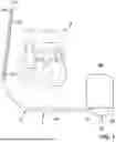 Fig. 02 - IMPLANTABLE CARDIOVERTER DEFIBRILLATOR DEVICE COMPRISING AN ANTENNA ARRANGED ON A LEAD