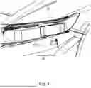 Fig. 02 - BRACKET ATTACHMENT STRUCTURE