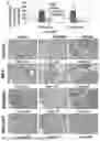 Fig. 44 - SELF-INACTIVATING LENTIVIRAL VECTOR ENCODING BETA- OR GAMMA-GLOBIN