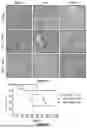 Fig. 50 - SELF-INACTIVATING LENTIVIRAL VECTOR ENCODING BETA- OR GAMMA-GLOBIN