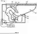 Fig. 09 - FLUSH ENGINE