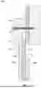 Fig. 02 - SKIRTING ASSEMBLIES AND METHODS