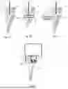 Fig. 02 - OPTICAL ANCILLARY DEVICE ATTACHED TO MICROSCOPE AND MICROSCOPE ASSEMBLY INCLUDING THE SAME