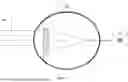 Fig. 02 - APPARATUS AND METHODS OF SPECTACLE SOLUTIONS FOR MYOPIA