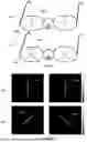 Fig. 06 - APPARATUS AND METHODS OF SPECTACLE SOLUTIONS FOR MYOPIA