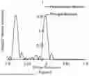 Fig. 08 - APPARATUS AND METHODS OF SPECTACLE SOLUTIONS FOR MYOPIA