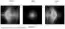 Fig. 22 - APPARATUS AND METHODS OF SPECTACLE SOLUTIONS FOR MYOPIA