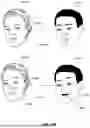 Fig. 46 - INTERPRETING FACIAL SKIN MOVEMENTS FROM LIGHT REFLECTIONS