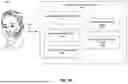 Fig. 82 - INTERPRETING FACIAL SKIN MOVEMENTS FROM LIGHT REFLECTIONS