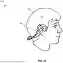 Fig. 97 - INTERPRETING FACIAL SKIN MOVEMENTS FROM LIGHT REFLECTIONS