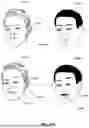 Fig. 46 - Detecting and utilizing facial micromovements
