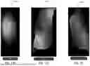 Fig. 27 - Providing Training Through Presentation of Visual Elements to Address Maladaptive Behavior of Users with Skin Pathologies