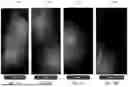 Fig. 28 - Providing Training Through Presentation of Visual Elements to Address Maladaptive Behavior of Users with Skin Pathologies