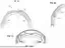 Fig. 06 - HEADSET WITH MAJOR AND MINOR ADJUSTMENTS