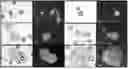 Fig. 01 - METHOD FOR PRODUCING HAPLOID, AND DOUBLED HAPLOID BETA VULGARIS PLANTS BY MICROSPORE CULTURE