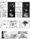 Fig. 02 - METHOD FOR PRODUCING HAPLOID, AND DOUBLED HAPLOID BETA VULGARIS PLANTS BY MICROSPORE CULTURE