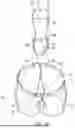 Fig. 11 - RELIEF GARMENT WITH MEDIAL PANEL