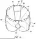 Fig. 14 - RELIEF GARMENT WITH MEDIAL PANEL