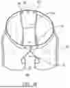 Fig. 16 - RELIEF GARMENT WITH MEDIAL PANEL