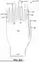 Fig. 10 - GLOVE WITH LONGITUDINAL STAYS