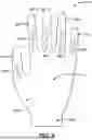Fig. 12 - GLOVE WITH LONGITUDINAL STAYS