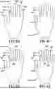 Fig. 14 - GLOVE WITH LONGITUDINAL STAYS