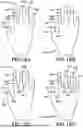 Fig. 23 - GLOVE WITH LONGITUDINAL STAYS