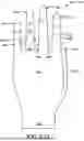 Fig. 25 - GLOVE WITH LONGITUDINAL STAYS