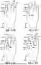Fig. 26 - GLOVE WITH LONGITUDINAL STAYS