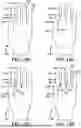 Fig. 32 - GLOVE WITH LONGITUDINAL STAYS