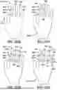 Fig. 35 - GLOVE WITH LONGITUDINAL STAYS