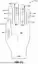 Fig. 36 - GLOVE WITH LONGITUDINAL STAYS